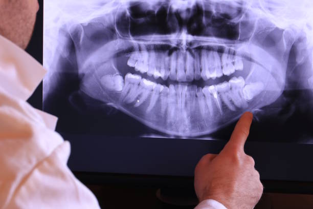 Best Emergency Dental Care for Sports Injuries in Wolfe City, TX